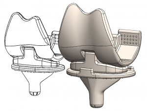 knee ceramic prothesis