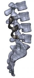 lumbar spinal fixation lombaire